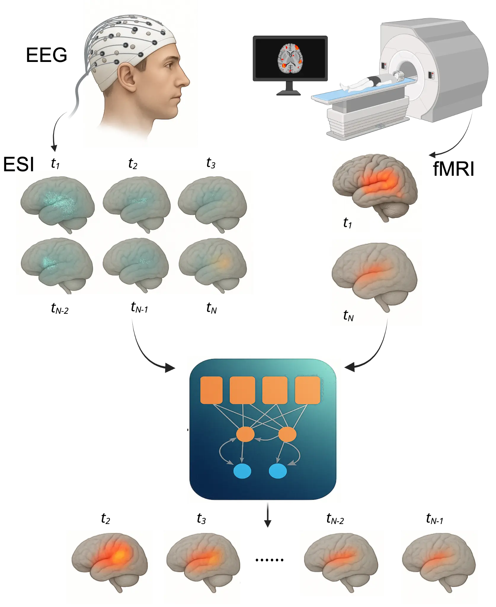 AI for Brain Imaging